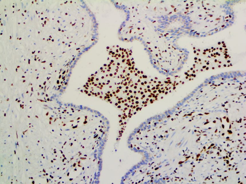 ERG – RMab