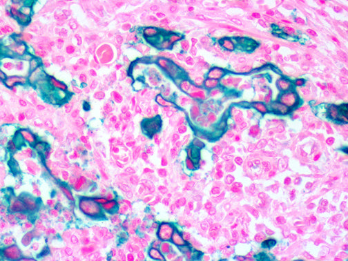 EpCAM/Epithelial Specific Antigen – MMab