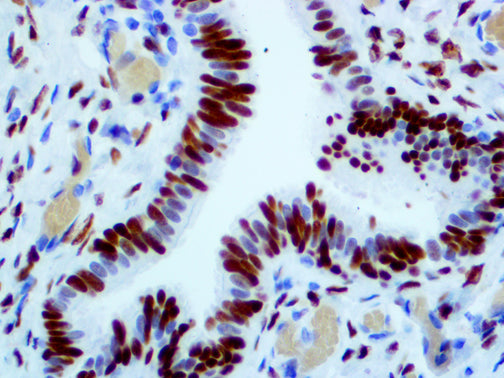 Estrogen Receptor – MMab
