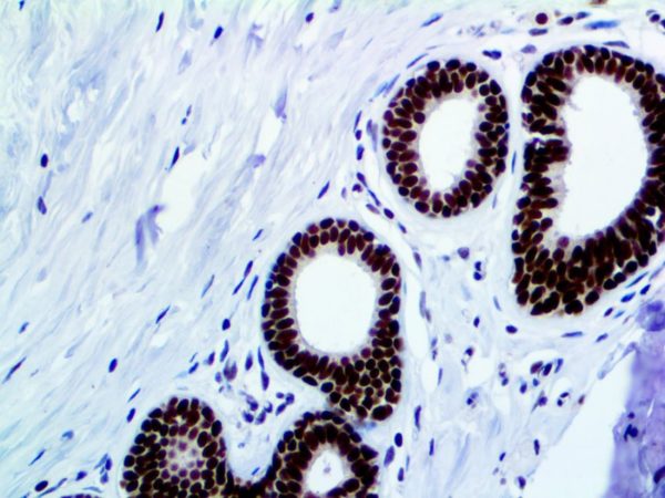 FOXP1 – RMab