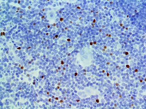 FOXP3 – RMab