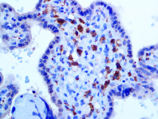 Factor XIIIa – RMab