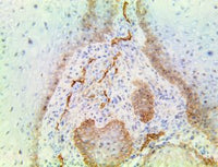 TintoFast Podoplanin (D2-40), MMab