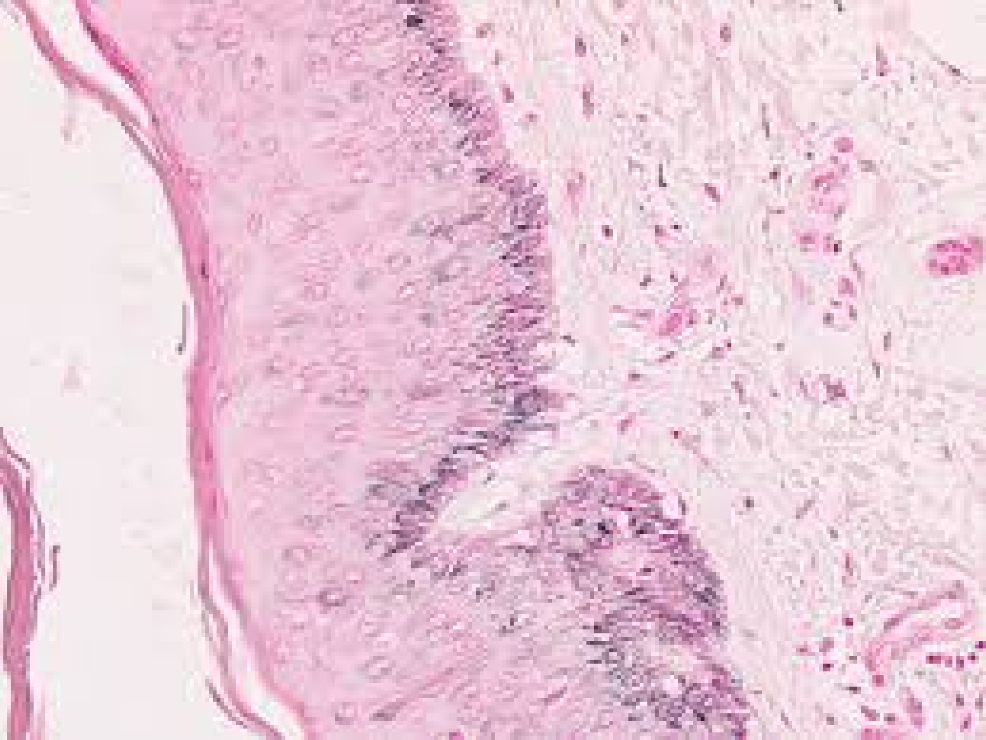 Fontana-Masson Stain Kit (For Argentaffin Cells and Melanin)