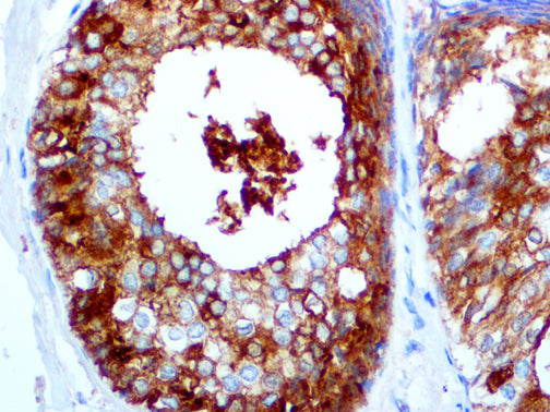 GCDFP-15 – MMab