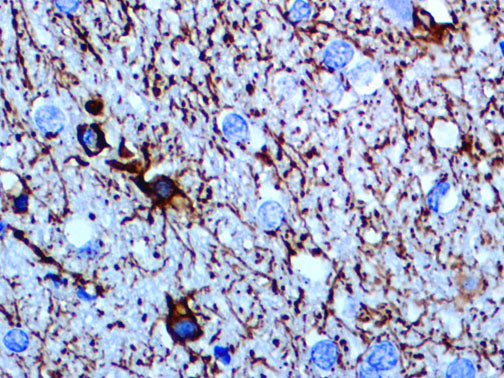 GFAP – MMab