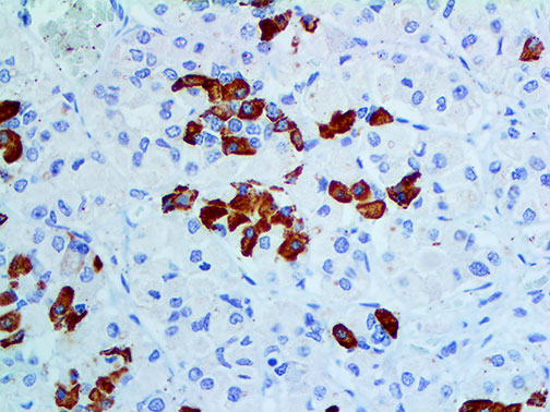 GH – MMab