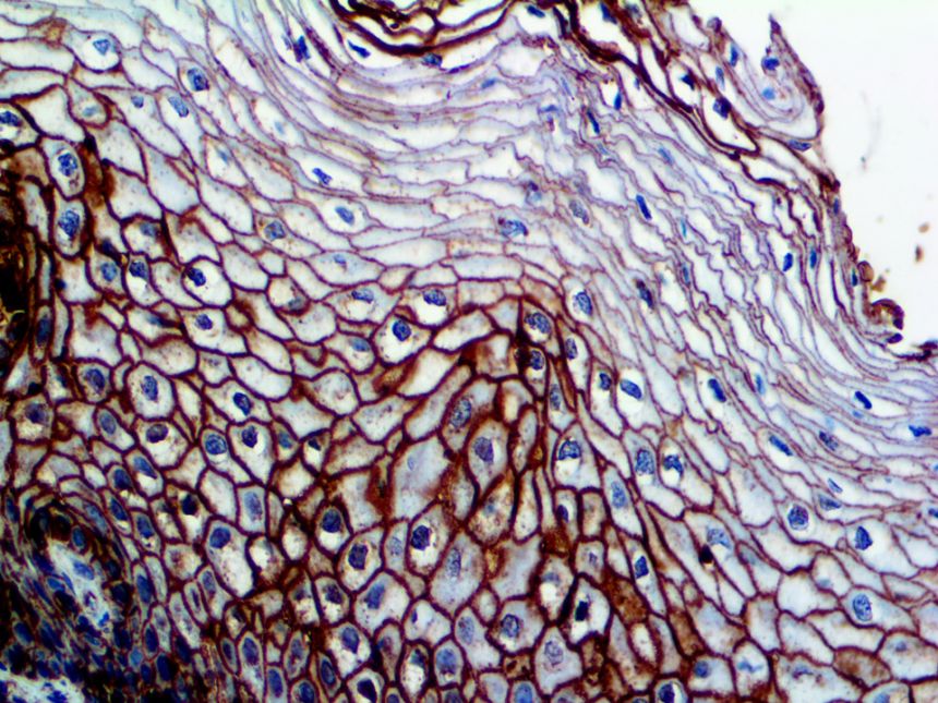 GLUT-1 – RMab