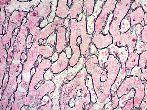 Reticulum Stain Kit (Modified Gomori's)