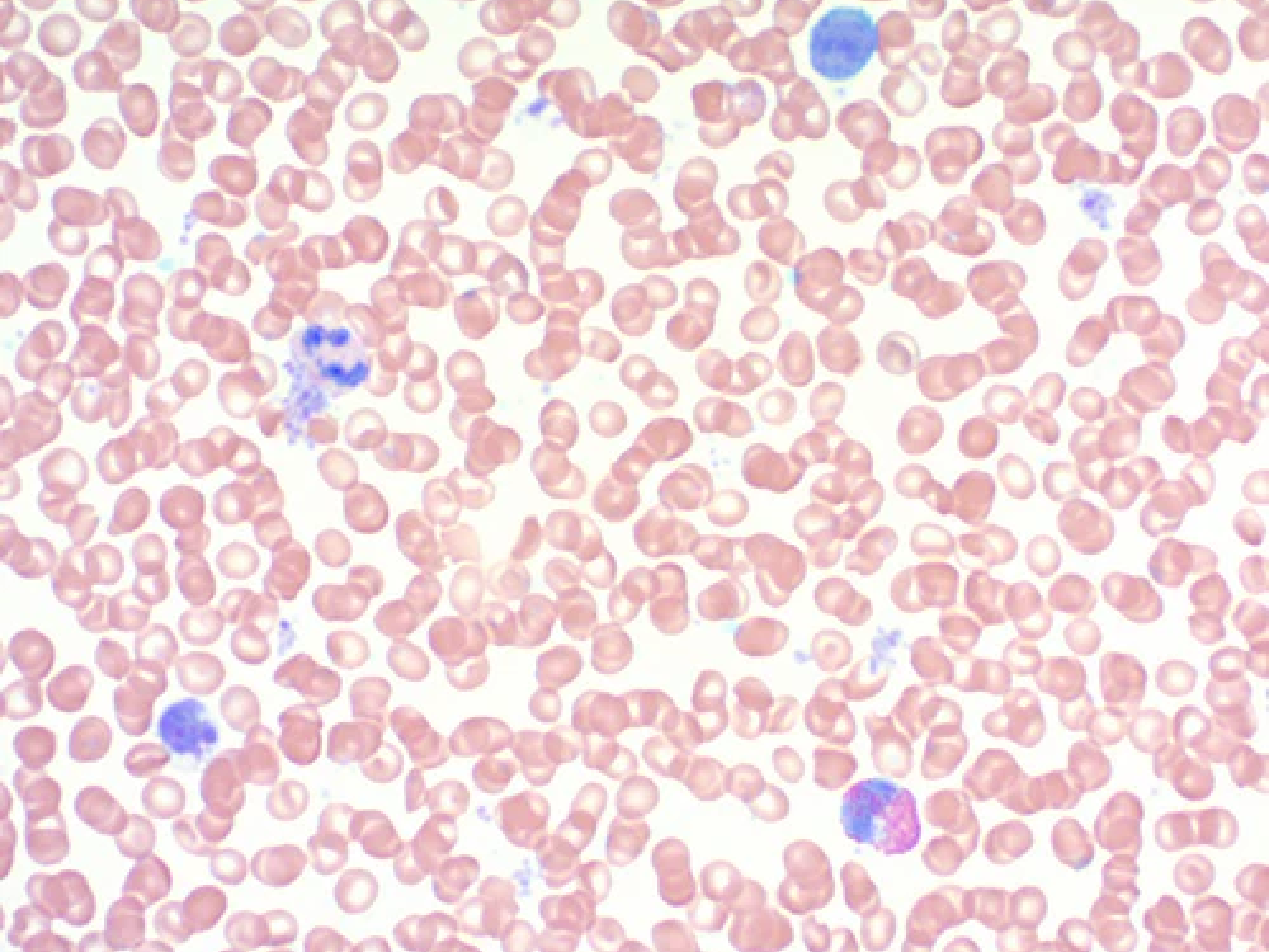 Giemsa Stain Kit (May-Grunwald)