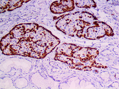 Glucagon – MMab