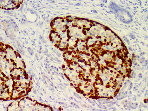 Glucagon – RMab