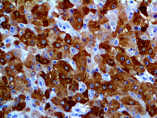 Glutamine Synthetase – MMab