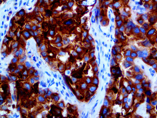 Glypican-3 – MMab