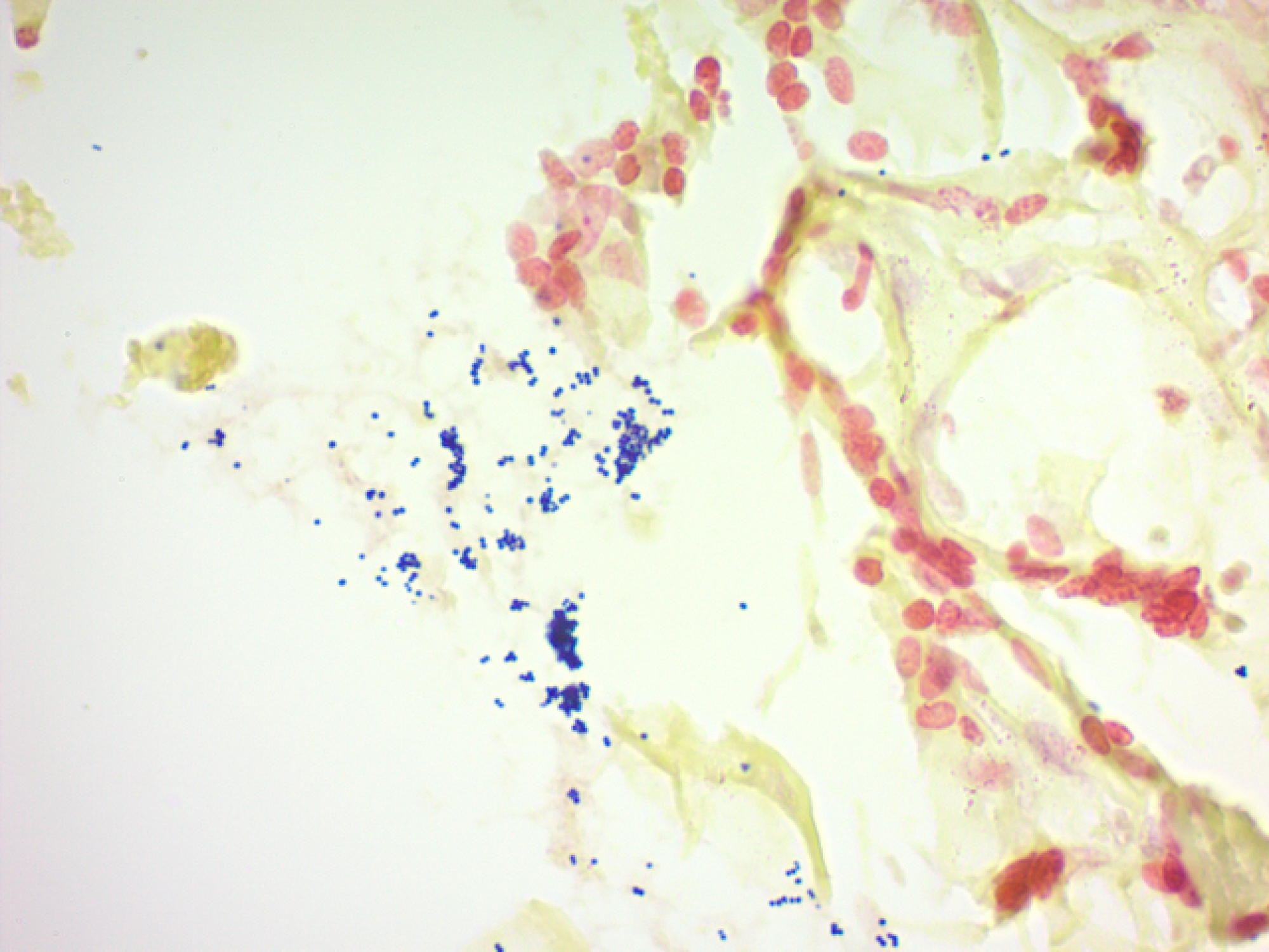 Gram Stain Kit (Modified Brown & Brenn)