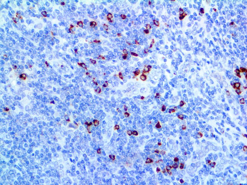 Granzyme B – RMab