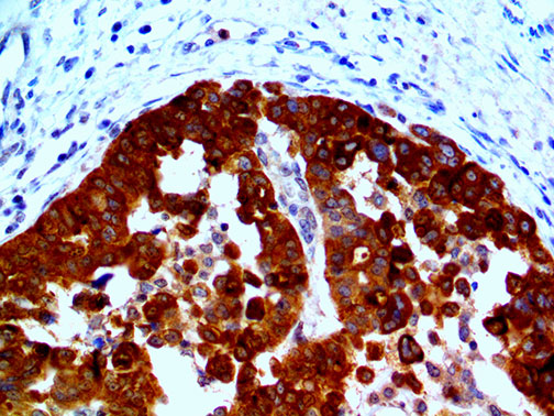 HE4 – RMab
