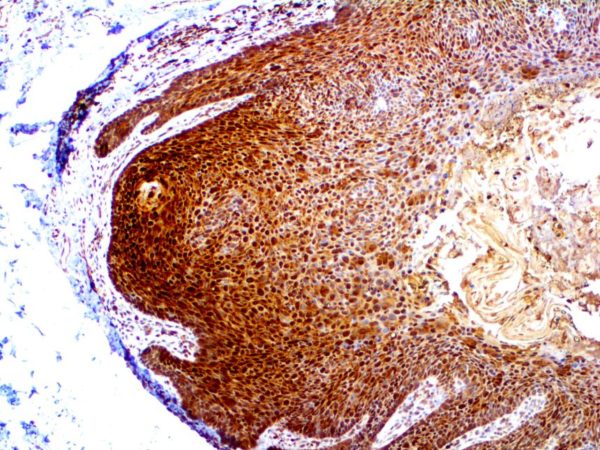 HIF-1a – Rmab