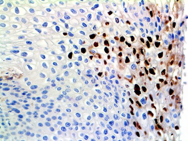 HPV – MMab