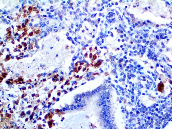 Herpes Simplex Virus I – MMab