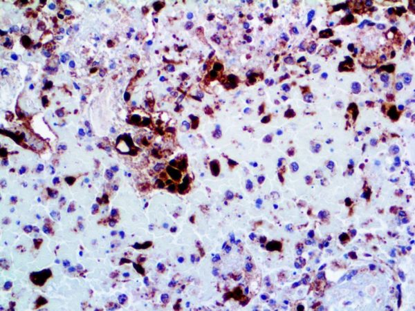Herpes Simplex Virus 2 – Rabbit Polyclonal