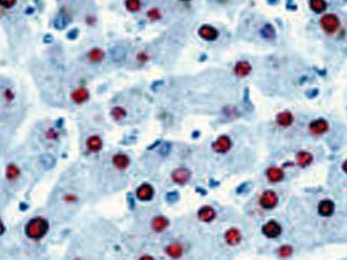 Hepatitis B Virus Core Antigen – Rabbit Polyclonal