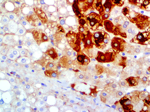 Hepatitis B Virus Surface Antigen – MMab