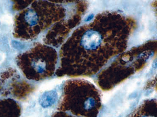 Hepatocyte Specific Antigen/Hep Par 1 – MMab