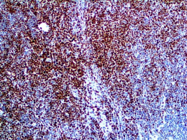 Histone H3 Phospho – Rmab