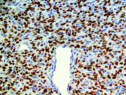 STAT6 – RMab