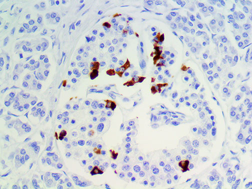 Somatostatin – MMab