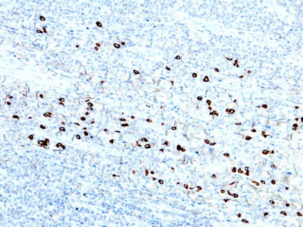 IgG4 – RMab