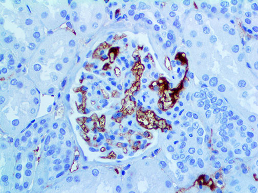 IgM – MMab