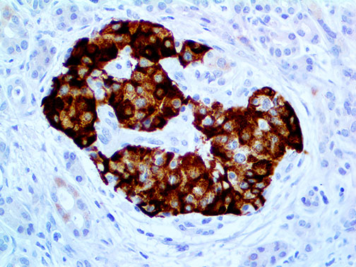 Insulin – MMab