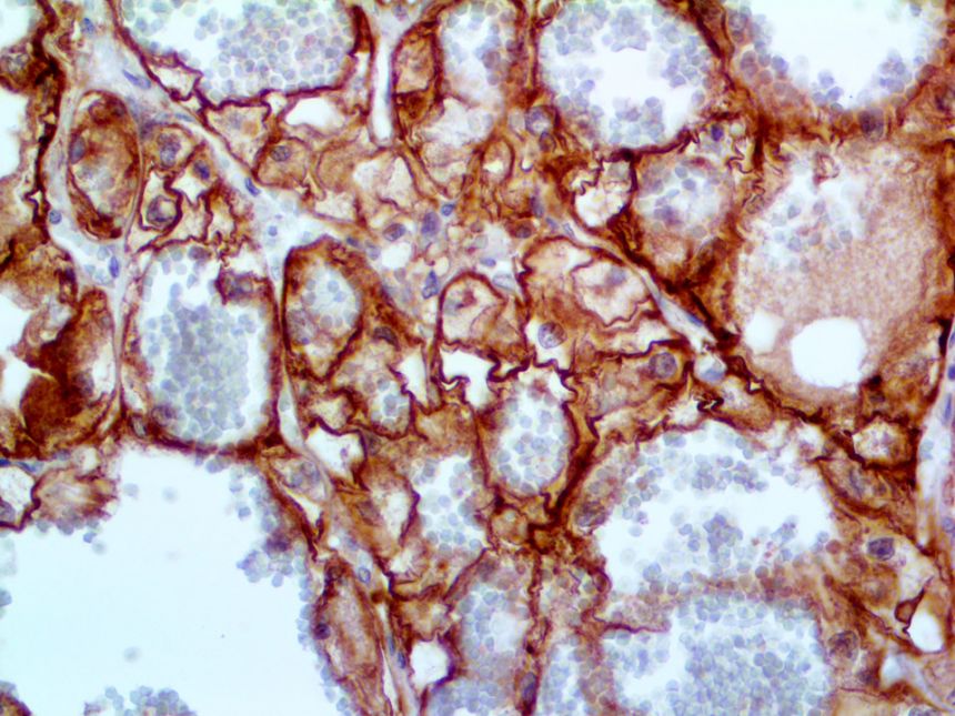 Ksp-Cadherin – MMAb