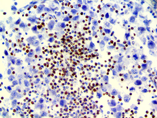 LEF-1 – RMab
