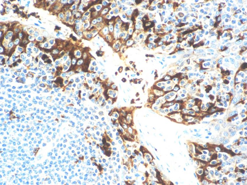 Lysozyme – Rabbit Polyclonal