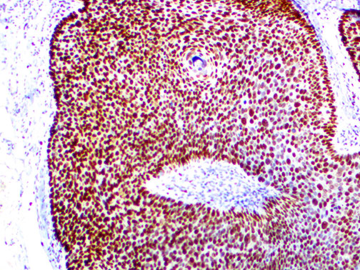 MCM2 – RMab