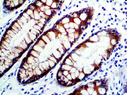 MUC1 – MMab