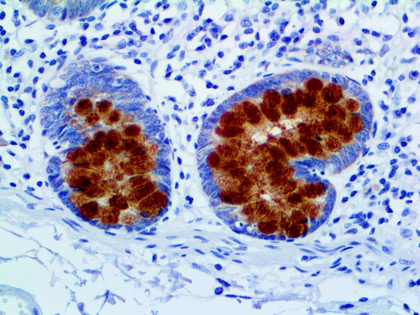 MUC2 – RMab