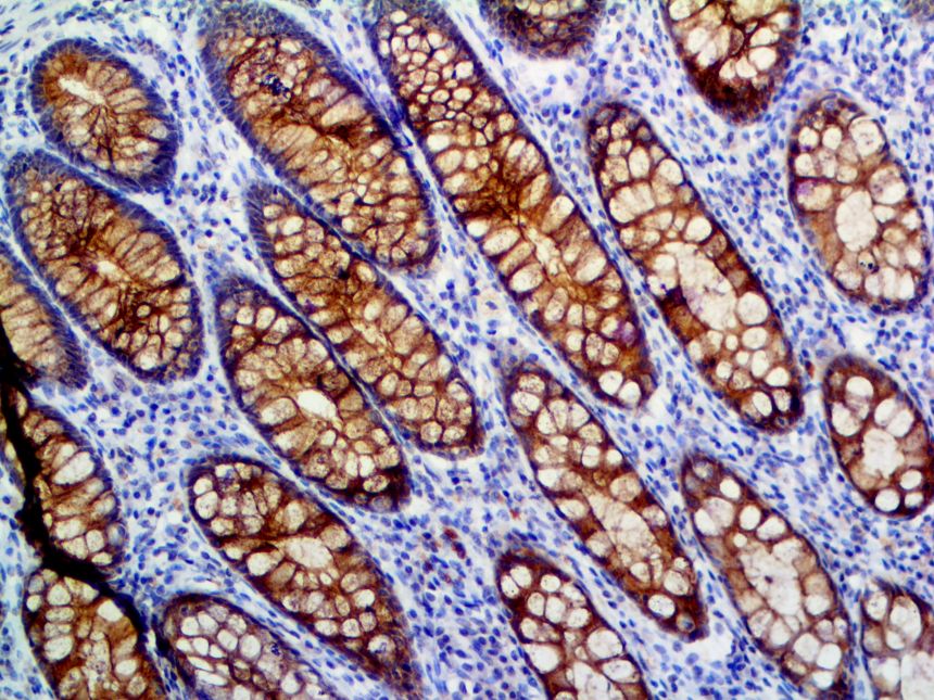 MUC4 – RMab