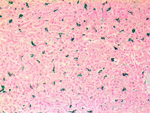 Macrophage/HAM-56 – MMab