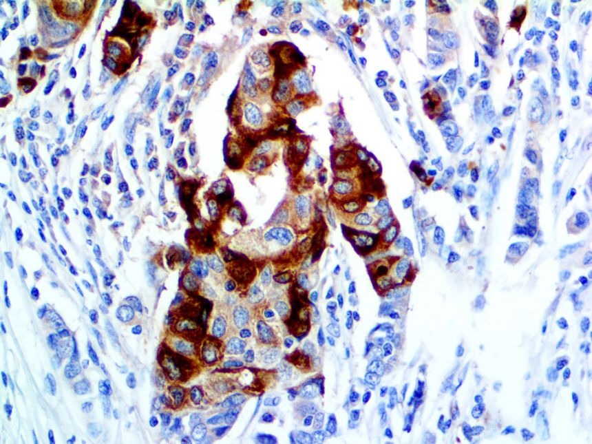 Mammaglobin – RMab