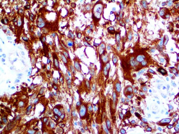 Tyrosinase – MMab