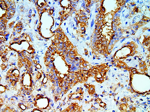 Mesothelial Cell – MMab