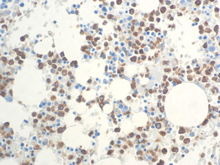 Myeloperoxidase – Rabbit Polyclonal