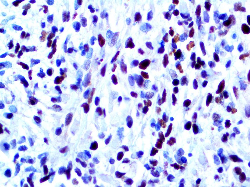 MyoD1 – RMab