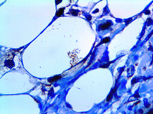 Myobacterium Tuberculosis – Polyclonal