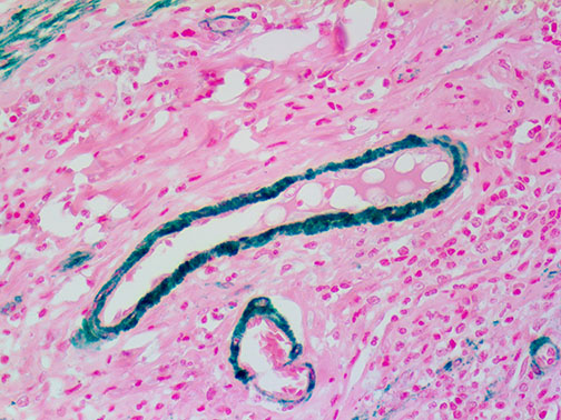 Myosin, Smooth Muscle Heavy Chain – MMab