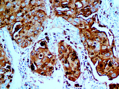 Napsin A – MMab